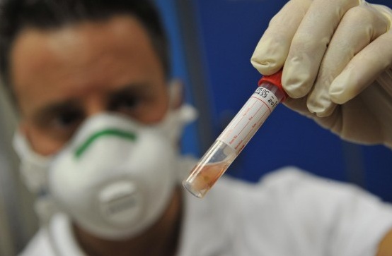 REGIONE: nessun caso di meningite in Piemonte