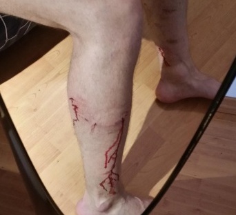 CRONACA: Azzannato da un cane mentre fa jogging