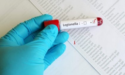 Epidemia Legionella: tre morti in Lombardia