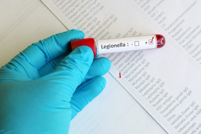 Epidemia Legionella: tre morti in Lombardia
