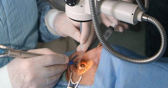 Quattro donne perdono un occhio dopo operazione