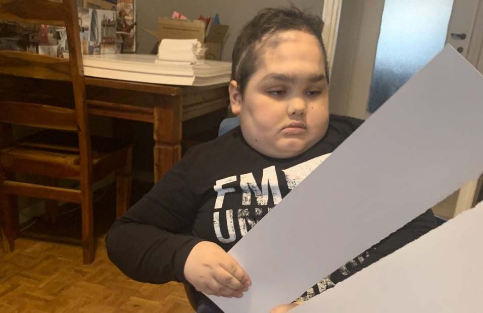 Alessandro, ragazzo speciale che un tumore al cervello ha reso cieco