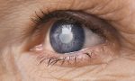 Glaucoma: visite gratuite per prevenirlo