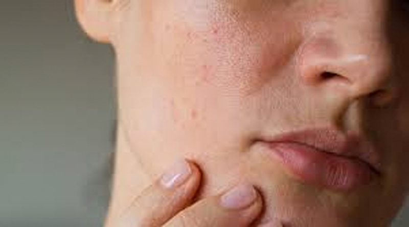La Dermatologia delle Regioni: Sabato 30 Novembre è a Vercelli