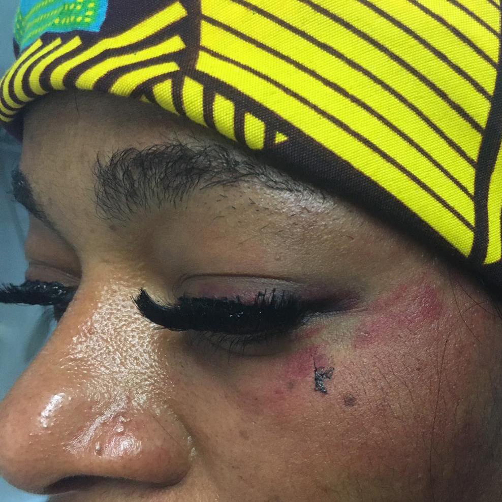 Arcigay Rainbow Vercelli Valsesia: aggressione omofoba