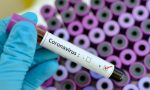 Coronavirus: un caso a Vercelli