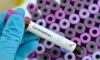 Coronavirus: secondo positivo nel Vercellese