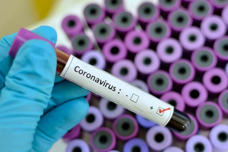 Covid Vercelli: nessun decesso e solo 18 casi con 29 guariti