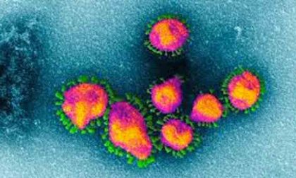 Emergenza coronavirus: altri due decessi in provincia di Vercelli