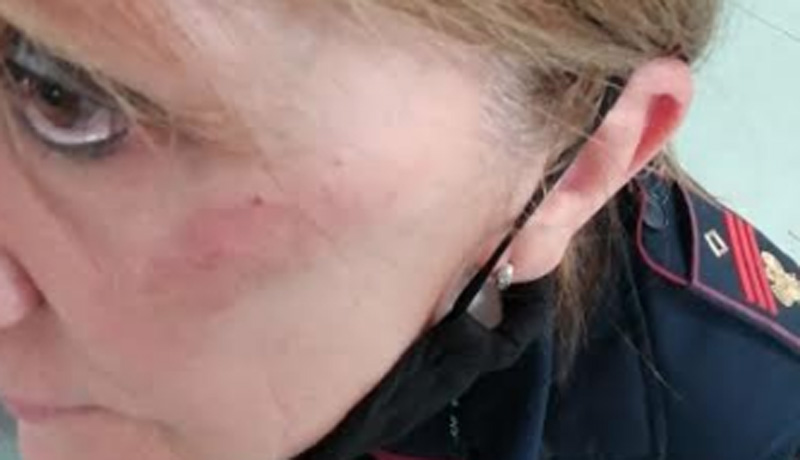 Poliziotta aggredita: libera la donna che la prese a calci perché le aveva interrotto l’happy hour