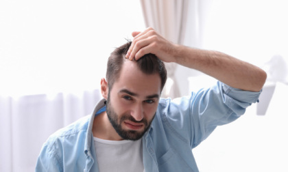 Trapianto capelli uomo: da Hairplace la soluzione definitiva al problema della caduta dei capelli