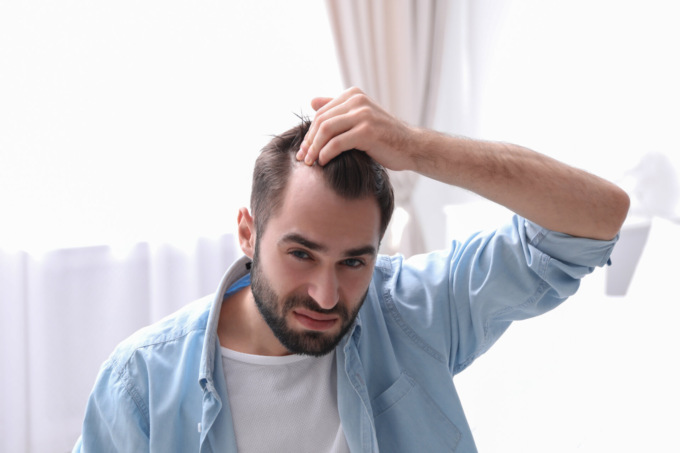 Trapianto capelli uomo: da Hairplace la soluzione definitiva al problema della caduta dei capelli